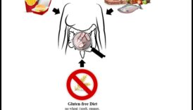 باليو وميكروبيوم الأمعاء: تفاعل ديناميكي