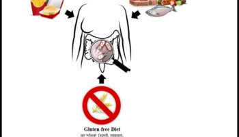 باليو وميكروبيوم الأمعاء: تفاعل ديناميكي